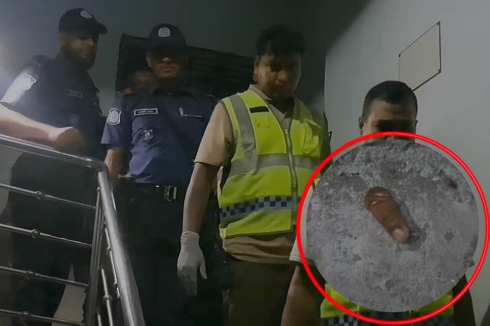 নাটোরে ৮ বছরের শিশুর আঙুল কেটে দেওয়ার অভিযোগ পুলিশ কনস্টেবলের বিরুদ্ধে