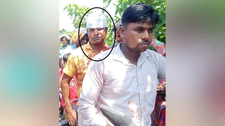স্কুলের সামনেই শিক্ষককে দা দিয়ে কোপানোর অভিযোগ, গুরুতর জখম