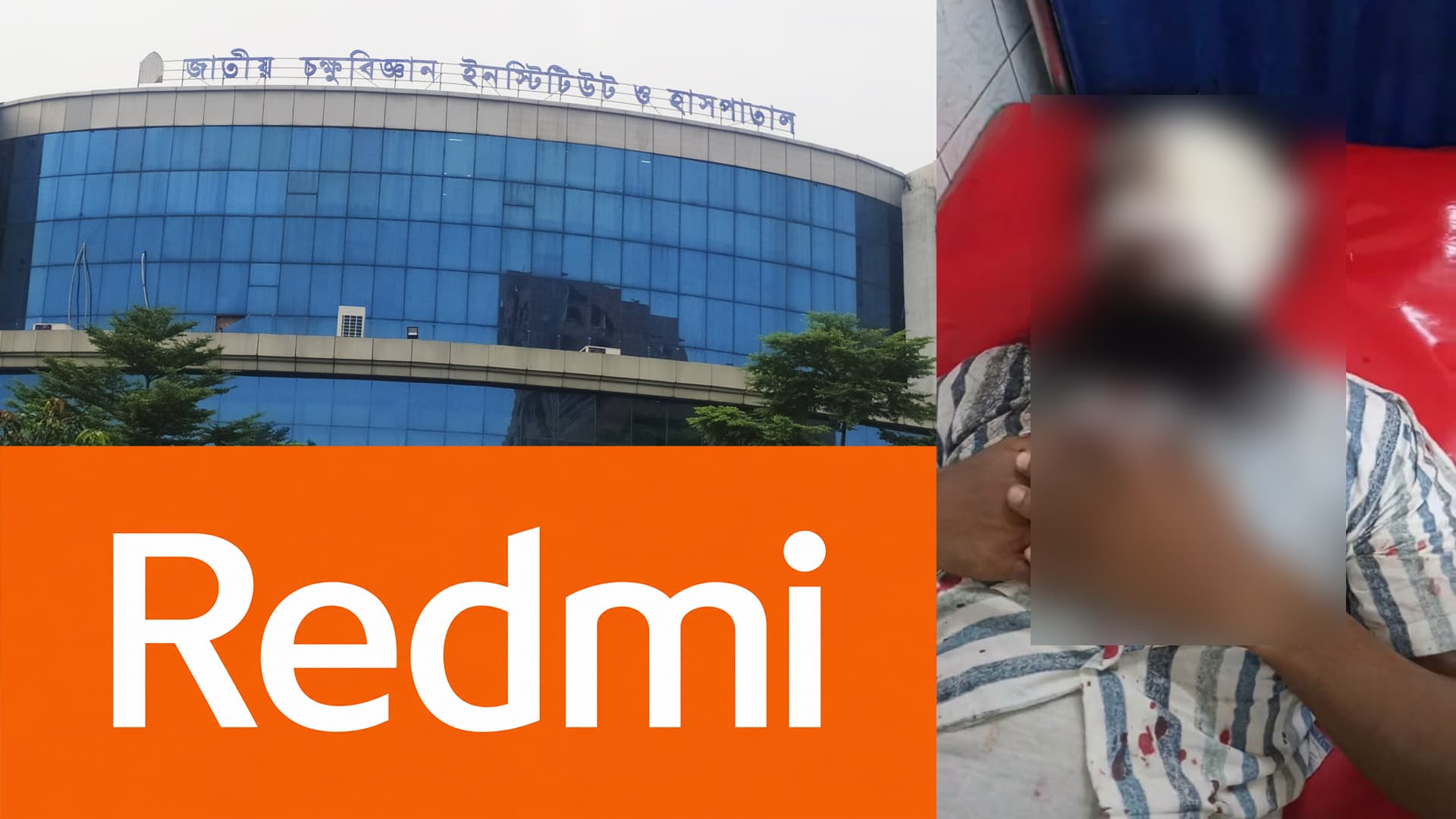 লক্ষ্মীপুরে রেডমি মোবাইল বিস্ফোরণে দুই বন্ধু মারাত্মক আহত: একজনের চোখের অবস্থা আশঙ্কাজনক